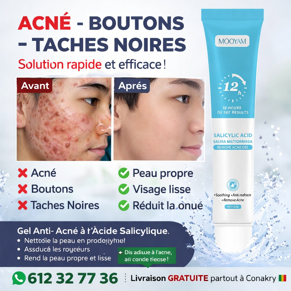 Gel Anti-Acné MOŌYAM – Élimine Boutons & Taches Noires en 12 Heures