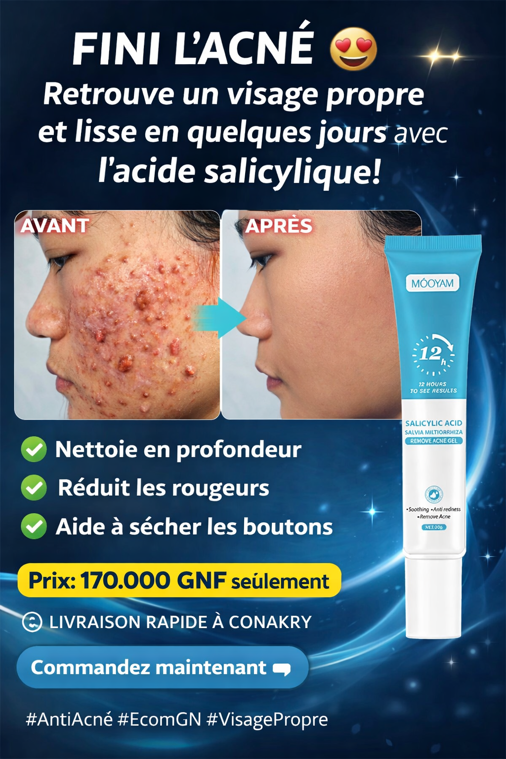 Gel Anti-Acné MOŌYAM – Élimine Boutons & Taches Noires en 12 Heures