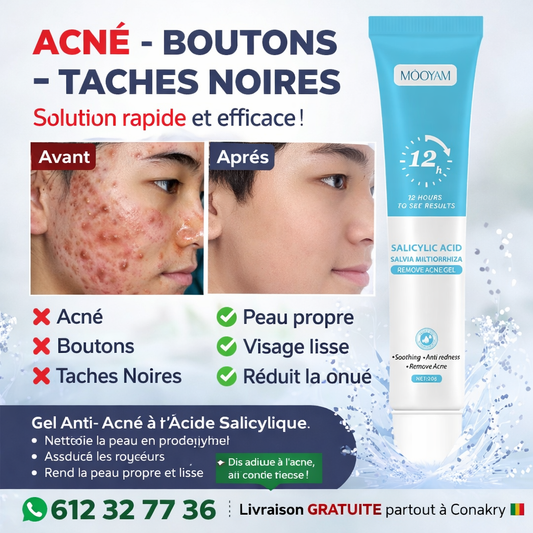 Gel Anti-Acné MOŌYAM – Élimine Boutons & Taches Noires en 12 Heures
