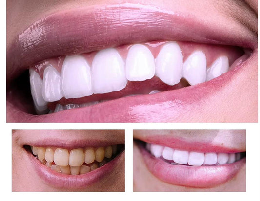 Mousse Blanchissante Dents Lanthome – Sourire Plus Blanc en Quelques Jours